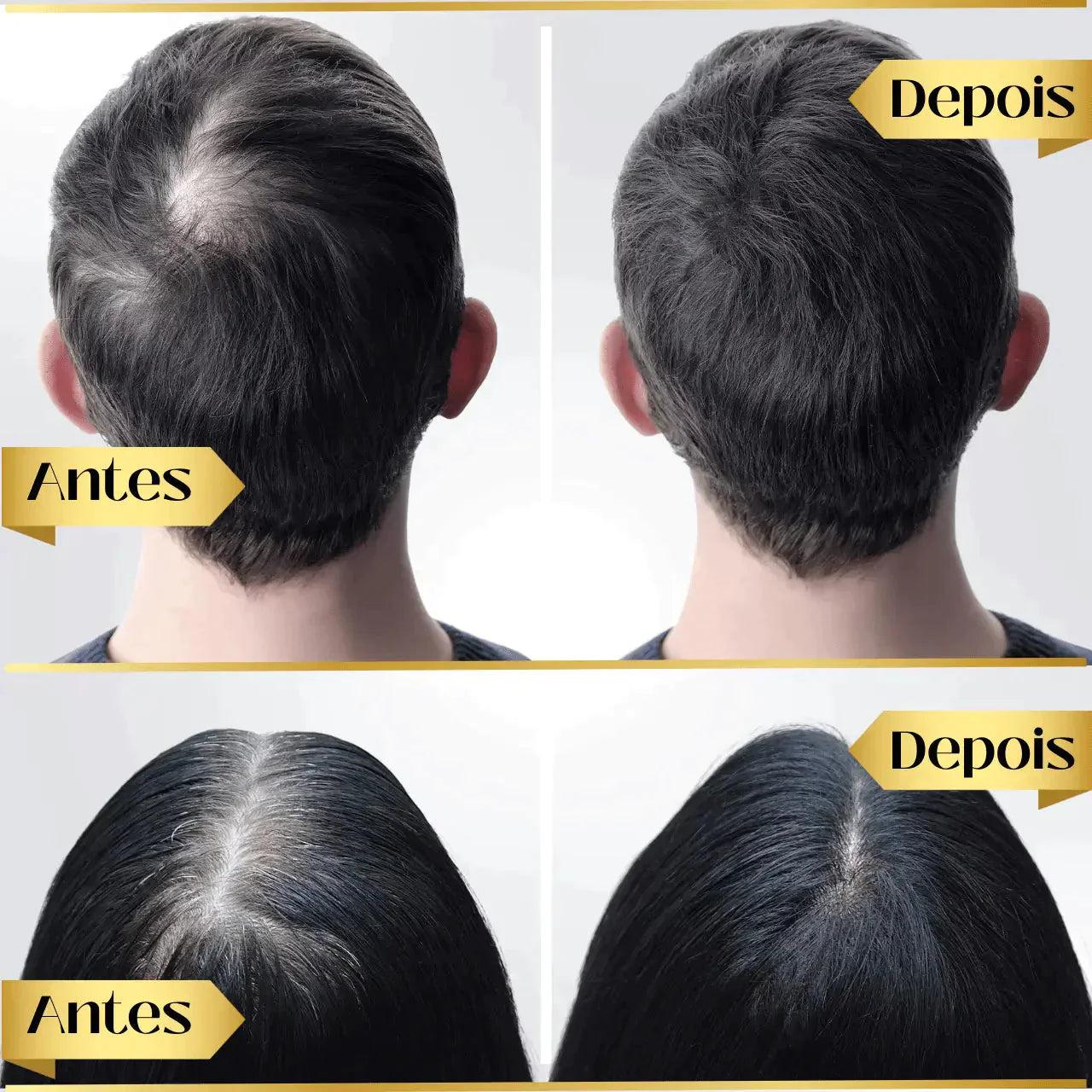 Repair Hair® | Óleo de Crescimento Capilar - Diminui Queda 95% e Aumenta Crescimento 20x - diminui-queda-95-aumenta-crescimento-20x-repair-hairr-pague-1-leve-2-0-techunt-403402_4dc5c61e-acd7-4c41-890d-107314e8999b
