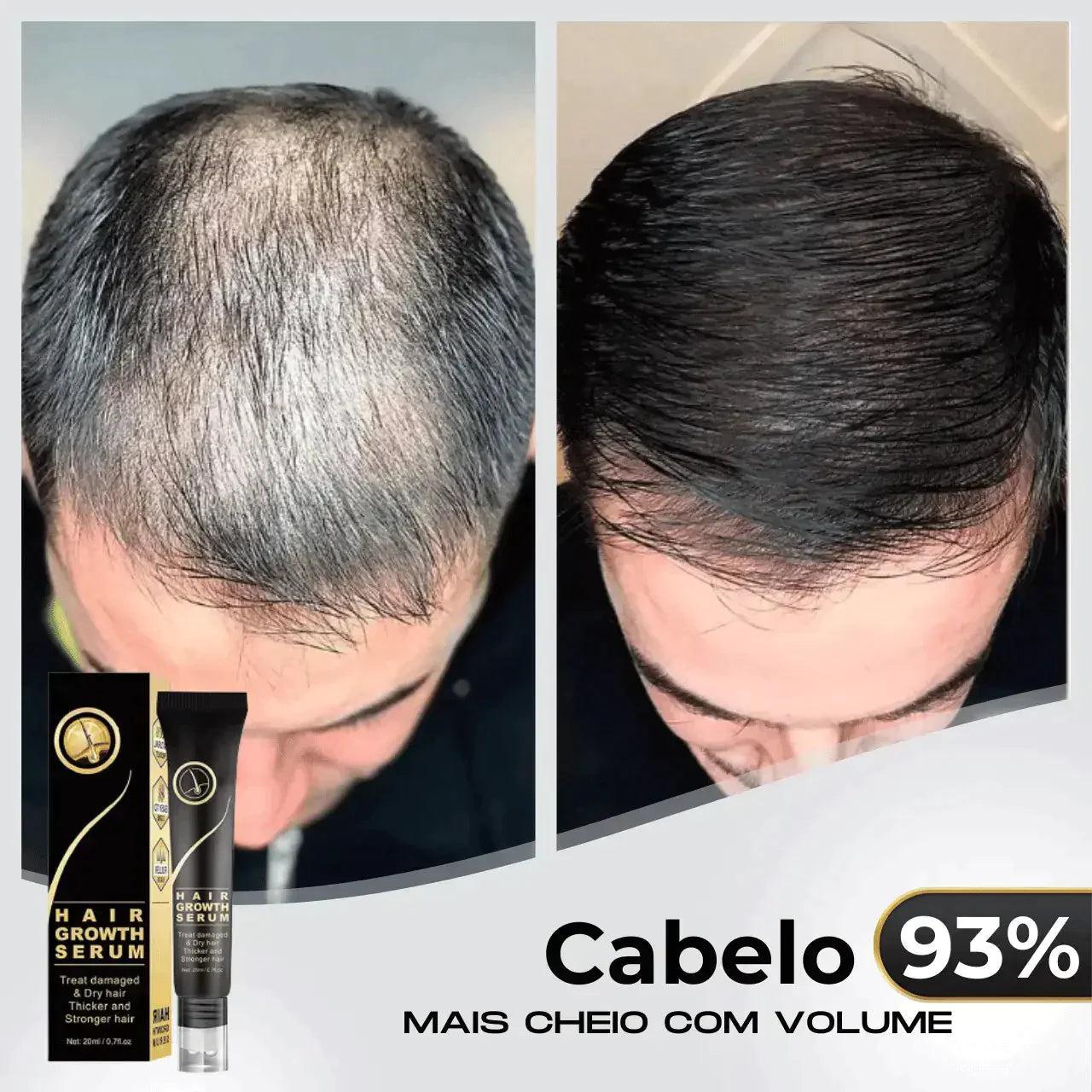 Repair Hair® | Óleo de Crescimento Capilar - Diminui Queda 95% e Aumenta Crescimento 20x - diminui-queda-95-aumenta-crescimento-20x-repair-hairr-pague-1-leve-2-0-techunt-718271_114b1dac-19a5-422d-b222-63614fd8f6ab